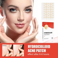 Eelhoe Hydrogel Acne Patch Invisible Makeup Closed Acne Patch Acne Cleansing Waterproof Breathable A