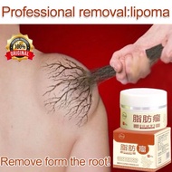 BAO JIAN GAO LIPOMA REMOVAL CREAM krim buang ketulan lipoma leher ketiak krim limfa pembersih lipoma