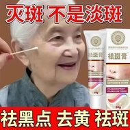 German Cleansing Freckle Removal Cream Freckle Blemish-Blemish-Blemish-Blemish-Blemish-Blemish-Blemi