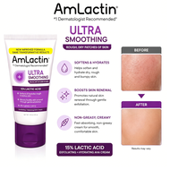 Hot Sale Promo AUTHENTIC AMLACTIN Ultra Smoothing Cream 15% Lactic Acid | KP Bumps Be Gone Cream for