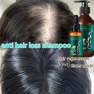 Dr.Jungle Anti-Hair Loss Ginger Shampoo Hair Growth Shampoo (500ml)