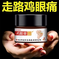 Corn Cream Ointment Genuine Product Remove Corn Cocoon Fleshy Hands Feet Dedicated Genuine Product20