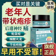 Relieve Itching Elderly People with Herpes Post-Shaped Herpes Neurosis Snake Cholesteros Tangling Wa