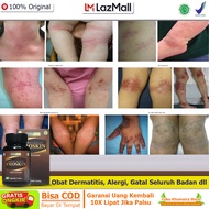 Obat Gatal Proskin - Obat Kaligata - Obat Gatal Kulit Membengkak - Gatal Runyam - Gatal Seluruh Bada