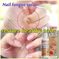 ❃ ▫ ♞,♘,♙️️Bonil Anti Fungal Solution 50ml Nail Repair Nail Fungal Treatment Anti-fungal Care Set T