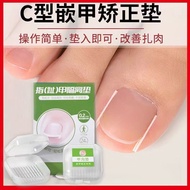Ingrown toenail correction tube for home use, nail pads for students, ingrown toenail correction tub