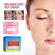 OUHOE Melasma Spot Out Cream 30g Melasma Cream Pekas Remover Dark Spots Remover Face Freckles Remover Cream