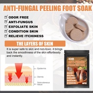 Eelhoe Foot Bath Foot Bath Patch Peeling Ginger Foot Bath Patch Cold Removal Moisture Onychomycosis Repair Foot Bath Patch
