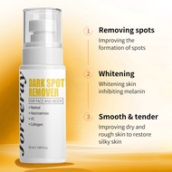 Fade Fine Spots Brightening Anti-Aging Removal Cream DARKSPOTREMOVER0ML