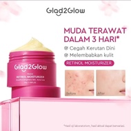 G2G GLAD2GLOW PEACH RETINOL MOISTURIZER SMOTHS AND BRIGTENS SKIN ACNE CARE 30GRAM