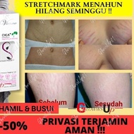 Vienna STRETCH MARK Removal CREAM STRETCH MARK CREAM ORIGINAL - ANTI Cellulite