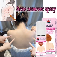 Tokyo Back Acne Spray Body Acne Treatment  (Back&Chest) 60ml Remove Acne Marks, Acne, Pimple, Scar A