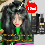 【BPOM】Obat penumbuh rambut serum penumbuh rambut hair tonic penumbuh rambut 30ml hair tonic penumbuh