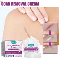 LANLOVE Surgery Dilute Scar Repair Cream Liquorice Tree Acne Removing Cream Herbal Effect Freckle Cream LE-MY