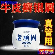 頑達康老頑固草本乳牛皮癬銀屑頭皮癬手足蘚皮膚瘙癢濕疹