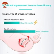 Amonghot> 2Pcs Ingrown Toenail Corrector Tools Pedicure Recover Embed Toe Nail Professional Ingrown 