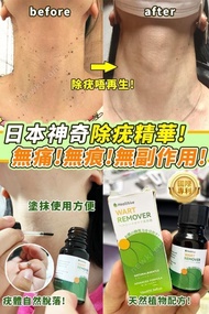 (現貨) 日本Healthive除疣精華液