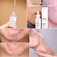 Serum the ordinary