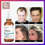 【100% From Canada】The Ordinary 60ML Original Authentic Hair Growth Essential Oils Care Essence Hair 