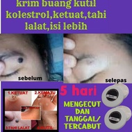 krim buang  Kutil ,di leher, Ketuat, Biji kolestrol dan Tahi lalat