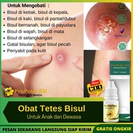 PROPOLIS SM Obat Bisulan untuk Anak dan Dewasa-Obat bisul di ketiak bisul di kepala bisul di kaki bi