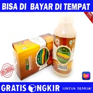 Obat Herbal Varises - Varises Bengkak Varises Pecah Ekstrim Varises Varises Esofagus Varises di Bet