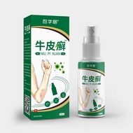 Dermatitis Eczema Cowhide Itching Itching Itching Itchy Skin Hand Foot Living Spray External Use Bod