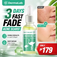 DermaLab Emu Renew Serum 30ml | For All Skin Types Pitted Scar Treatment | Moisturizing | Whitening