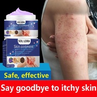 Antipruritic Cream Antifungal Cream skin Topical cream anti-itch cream Ringworm removal cream Effect