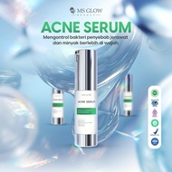 Ms Glow Serum Acne Ori Asli / Acne Serum Ms Glow Original Bpom / Serum Penghilang Jerawat / Perawata