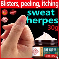 ubat gatal kulit krim gatal kulit eczema cream Anti bacterial Anti Itching Sweat Herpes Treatment Ps