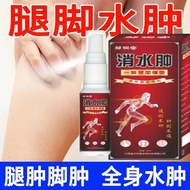 [Old Brand Reduce Swelling Pain Removal Spray Sedentary Sitting Legs Foot Edema Spray Elderly Foot E