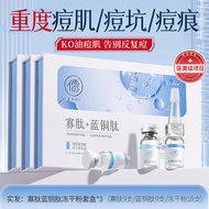 Peptide Drying Powder Facial Serum ลดรอยสิว รักษาหลุมสิว กระชับรูขุมขน ลดรอยสิว ป้องกันการเกิดสิว สำ