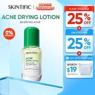 [NEW LAUNCH] SKINTIFIC Acne Drying Lotion Salicylic Acid Acne spot treatmen Acne Scar Serum Essence