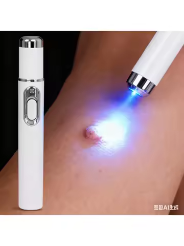 Blue light wart removal tools to make your life better.