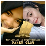 💓 HW GLOW SKINCARE - PAKET GLOW SKINCARE / AMAN BUMIL BUSUI BISA