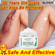 ◈☢Original Aliver Peklat Remover Cream For Old Peklat 50Ml Scar Remover For Old Scar On Leg Remove S