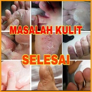 UBAT KULIT, PENAWAR PSORIASIS, UBAT KURAP, KULIT BERSISIK, UBAT BADANG, TUMIT PECAH, ECZEMA, KULIT B