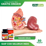 Obat Penyakit Radang Ginjal - Gamat Emas Kapsul Multikhasiat 100% Original by Acep Herbal Official