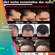 serum penumbuh rambut obat penumbuh rambut penumbuh rambut botak serum