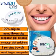Snap On Smile Authentic / Gigi Palsu Snapon Smile 1 Set Veneer Gigi