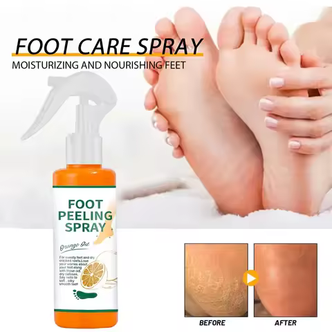 100ml Foot Peeling Spray Orange Essential Oil Exfoliating Nourish Peel Feet Calluses Dead Skin Remov