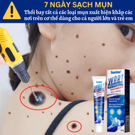 Gel Tẩy Nốt Ruồi TẨY SẠCH TẬN GỐC TẤT CẢ CÁC LOẠI MỤN RUỒI MỤN CƠM MỤN CÓC SẸO LỒI THỊT THỪA Tẩy N