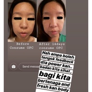 Skin problem anti aging fat burner weight loss supplement scar acne pigmentation KenMen OPC