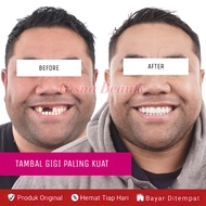 PAKET 2 PCS Gigi Palsu Penutup Ompong 100% ORIGINAL Penambal Gigi Berlubang Gigi Palsu Permanen Kuat