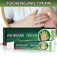 Anti-Itch Ointment Body Psoriasis Dermatitis Pruritus Treatment Cream