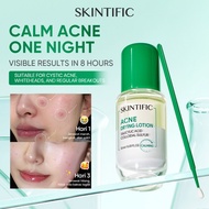 SKINTIFIC Acne Drying Lotion Salicylic Acid Anti-Acne Serum Acne Patch Treatment Fade Acne Scars uba