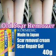 Scar Removal Cream Skincare Repair Blackhead Acne Spots Acne Scar Treatment Treats Acne Scars, Burns