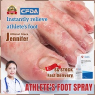 💥SG stock💥 Athlete foot spray / Anti fungal foot cream / Foot odor remover spray / Foot deodorant sp
