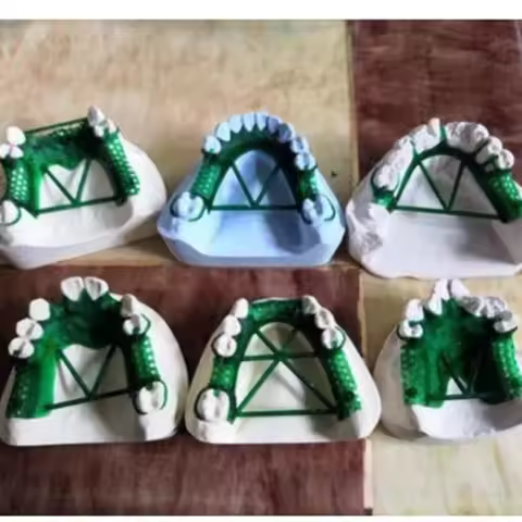 Dental Casting Resin 3D Printing UV Photosensitive LCD DLP High Hardness Non Deformation High Precis